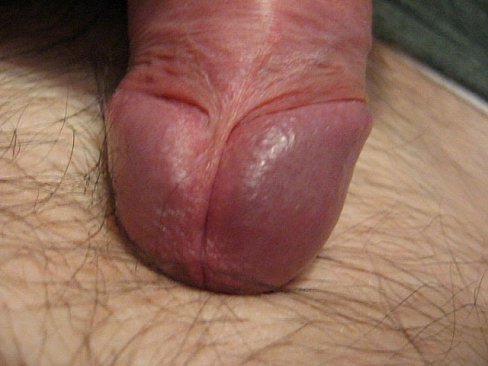 Big fat wrinkly penis