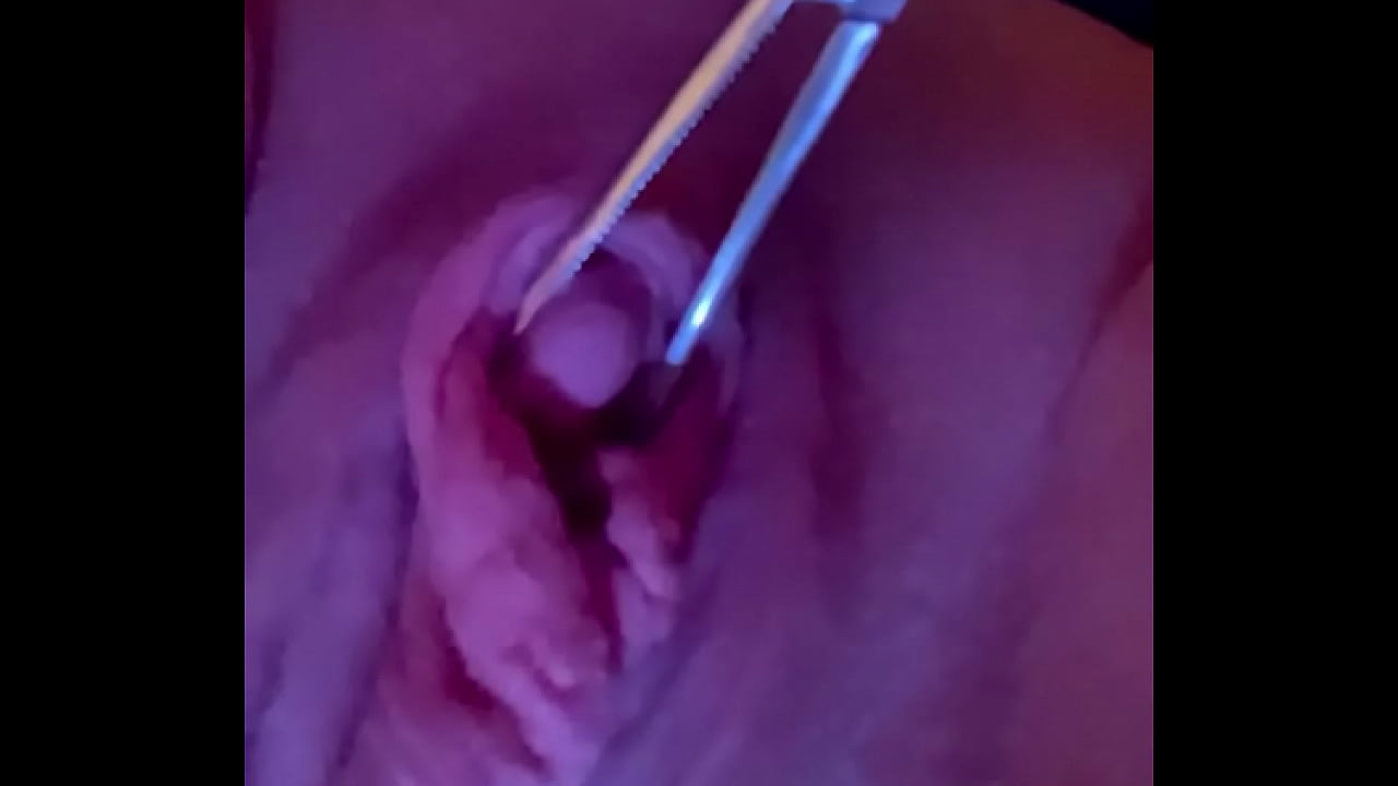 Clit jacking w forceps squeezing