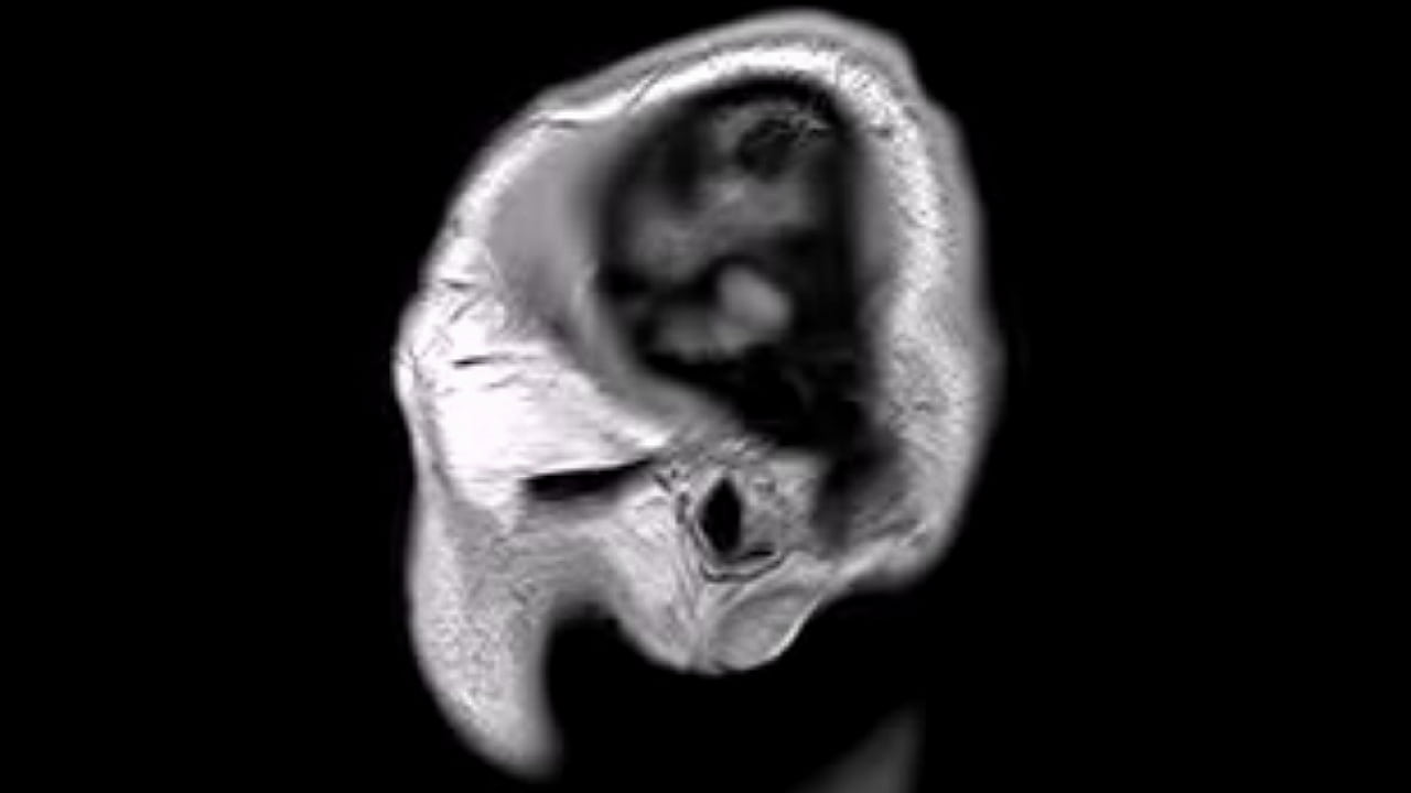 Structural MRI animation