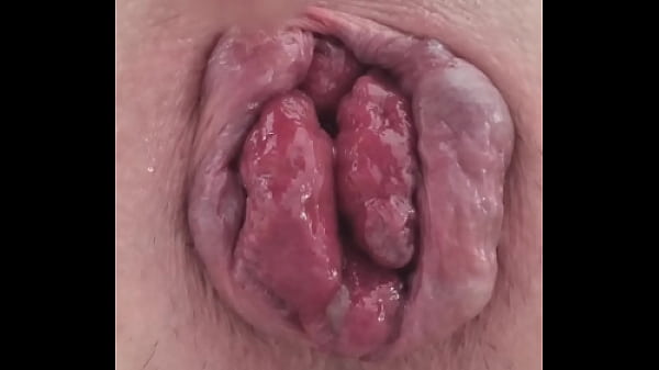 Prolapse followed by selffuck  