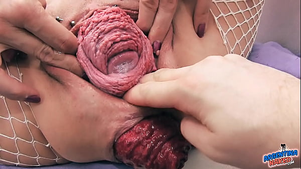 Most Incredible Prolapse Scene! Cervix, Fisting, Max Stretch