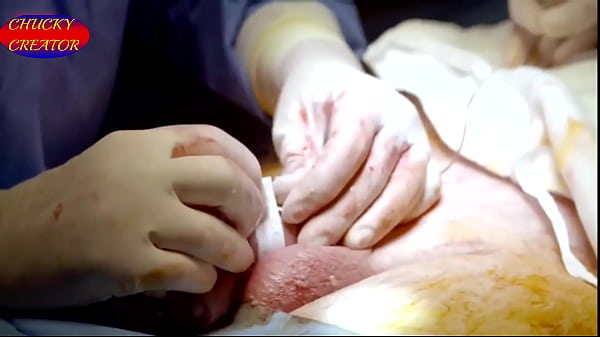 My Enlargement Surgery (Penile Girth and Length Surgery) for &pound;8495