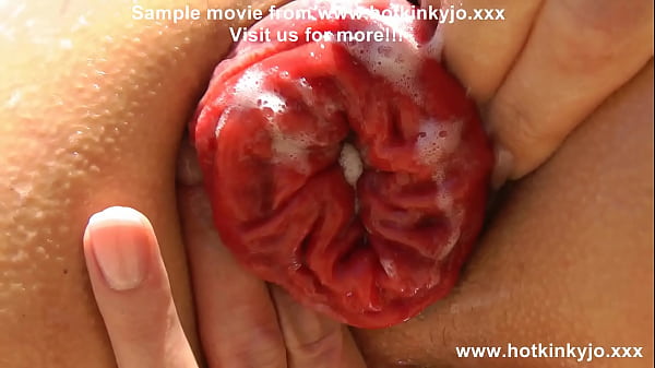 Hotkinkyjo fisting anal prolapse public 14.11.2022