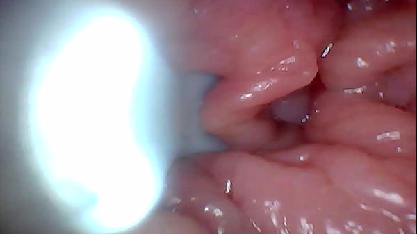 First time: An endoscope reveals the G-spot up close &ndash; without mounting!