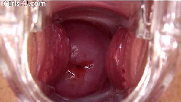 1-Silvie IrSilvie Irish model gaping and stretching52