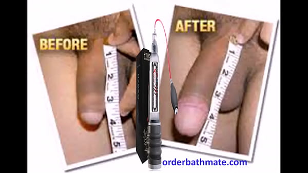 Enlarge Your Penis with Bathmate Pump-Hydromax Pump