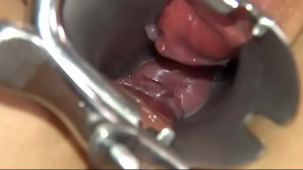 Camera deeply in her gaped vagina vagina  