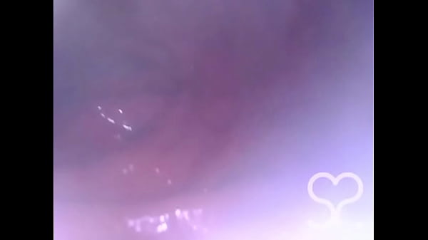 Anal Endoscope all the way in my Transverse Colon!  