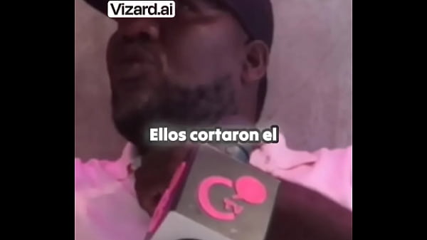 Complicaciones tras una cirug&iacute;a: un testimonio impactante #elchicletv #negligencia #chiclenoticias #malapraxis #testimoni...