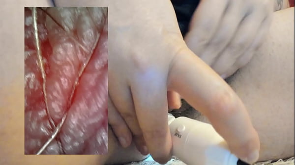 Extreme vore compilation - Extreme vaginal endoscopy orgasm