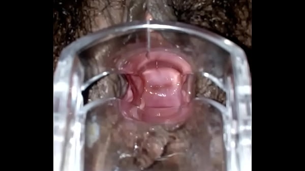 SLIM INDIAN BROWN GIRL CERVIX SPECULUM CHECK VAGINAL OPENING