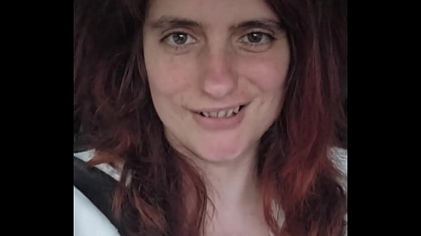 Chloecoquine - update #20 - Aug 10, 2024 