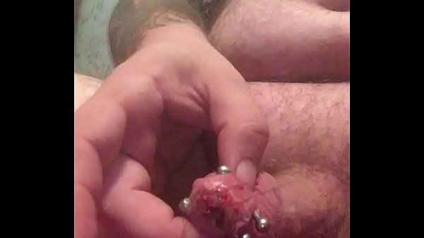 Exploring Urethral Plugging