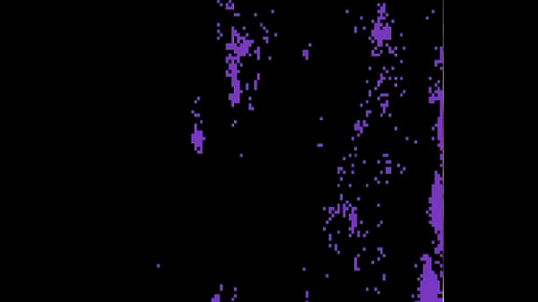 Limpieza oral profunda  