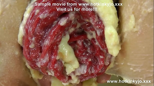 HKJ anal cake fisting