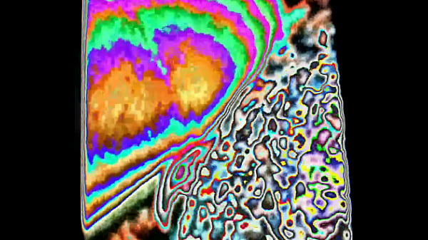 Erectile dysfunction solutions