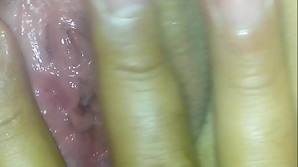 Exame em casa com o ginecologista