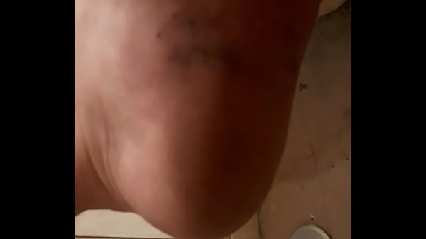 Pie sudado y sin duchar