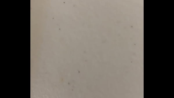 Chronic masterbation  