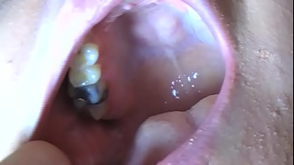 Fifi Foxx Shows Off Fucked Up Teeth