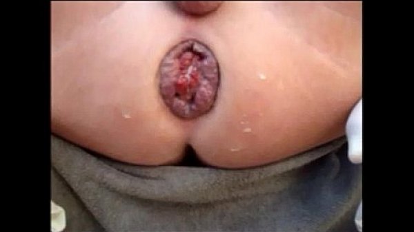 Big Monster Pleasure Tulip Rose Rosebutt Rsturbation Close Ups Fisting 99 Bi Men