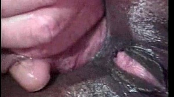 Pica branca no c&uacute; da neguinha