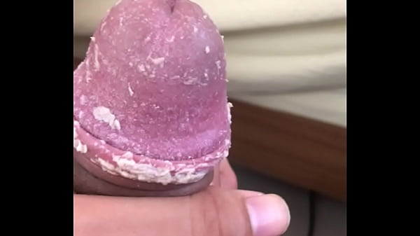 For the smegma lovers 