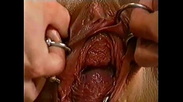 Monster Vagina. Extreme piercing. Fisting
