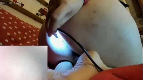 FartsEndoscopeAssholeHairy 20 11.mp4