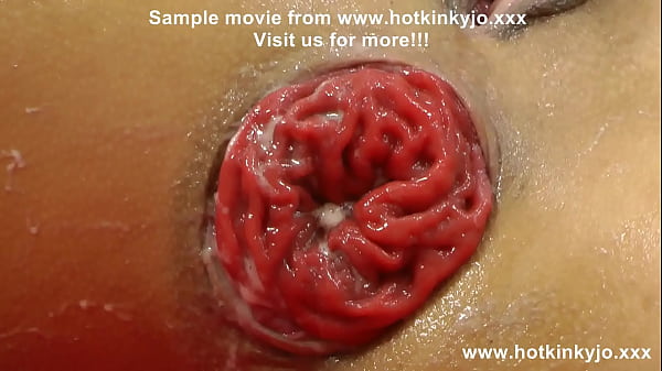 Hotkinkyjo fisting, gape & prolapse 5.12.2022