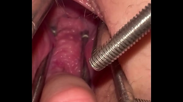 Extreme pussy stretching