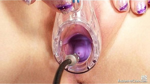 Zaneta has her pussy gyno speculum examined by old doctor  