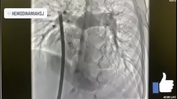 Aguascalientes M&eacute;xico  