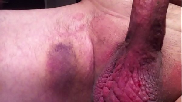 cock and ball spanking and whipping