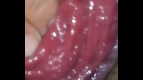 Big prolapse extreme  