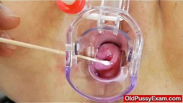 Milf gyno done right with a spekula