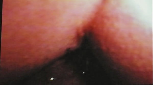Gaping hairy  anal