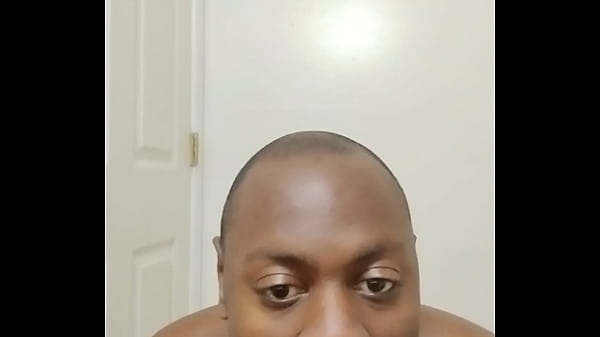 I had another chance to keep growing facial hair out and this happened for free are followers okay when this happens 1  