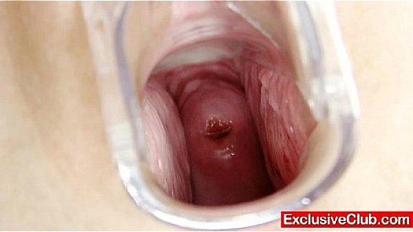 Chubby amateur girl with glasses fingered by gyno MD