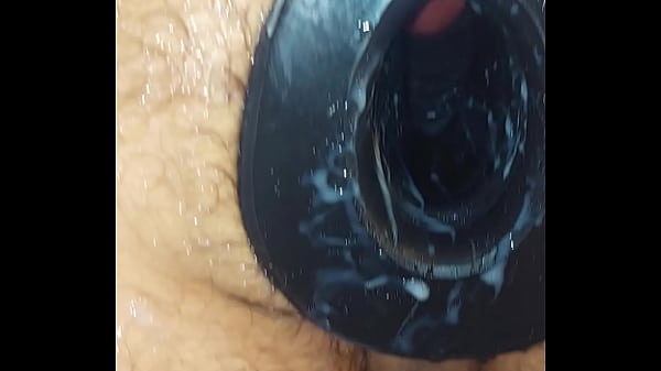 Фистят открытый анус