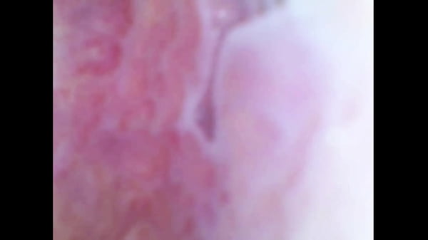 Real pussy orgasm contraction cam inside pussy!!! Sperm found in pussy juice under microscope!!!