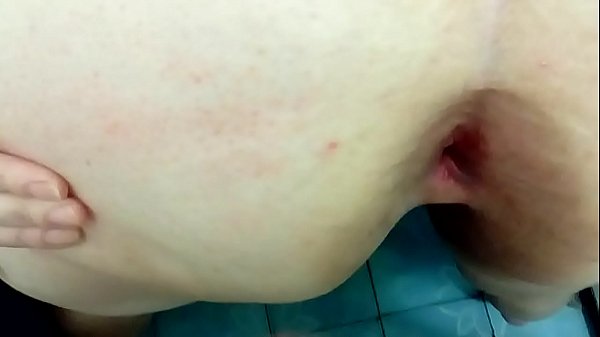 Anal big ass fat bbw fisting