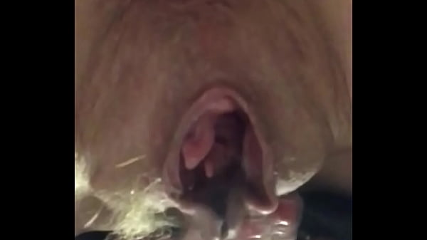 Extreme graphic speculum fuck and gape