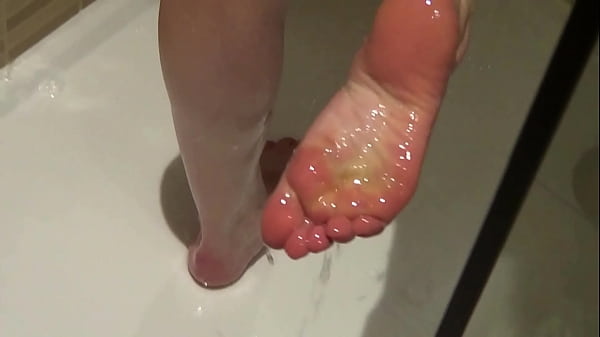 A back covered with moles !