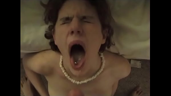 Massive facial for 18 year old