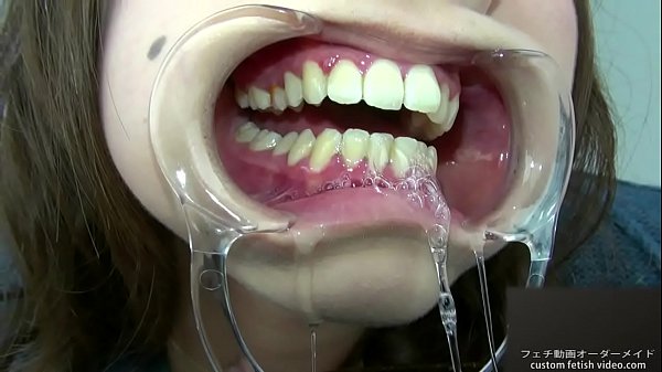 Teeth fetish