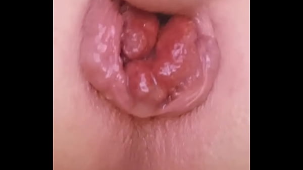 Close-up rosebud prolapse and selffuck  