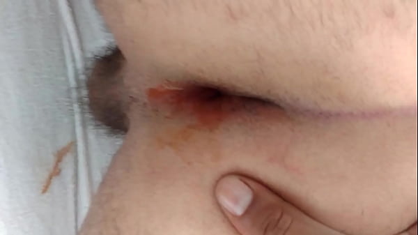 l&eacute;o levando pika 