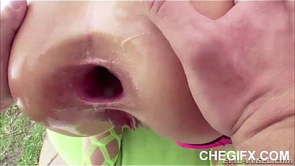 Anal Gape Report 2