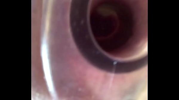 DEEP BUTTHOLE EXAMINATION